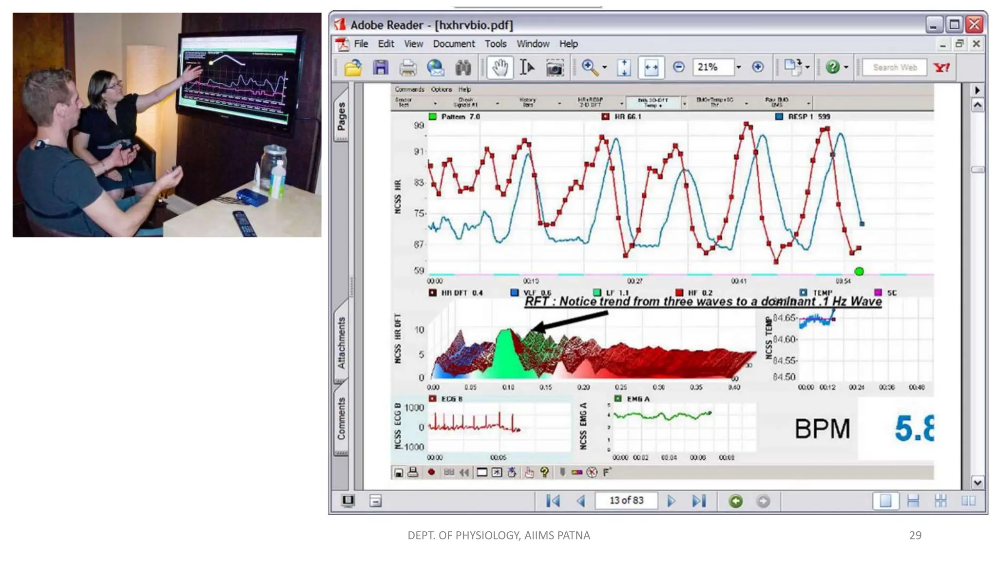 29
DEPT. OF PHYSIOLOGY, AIIMS PATNA
 
