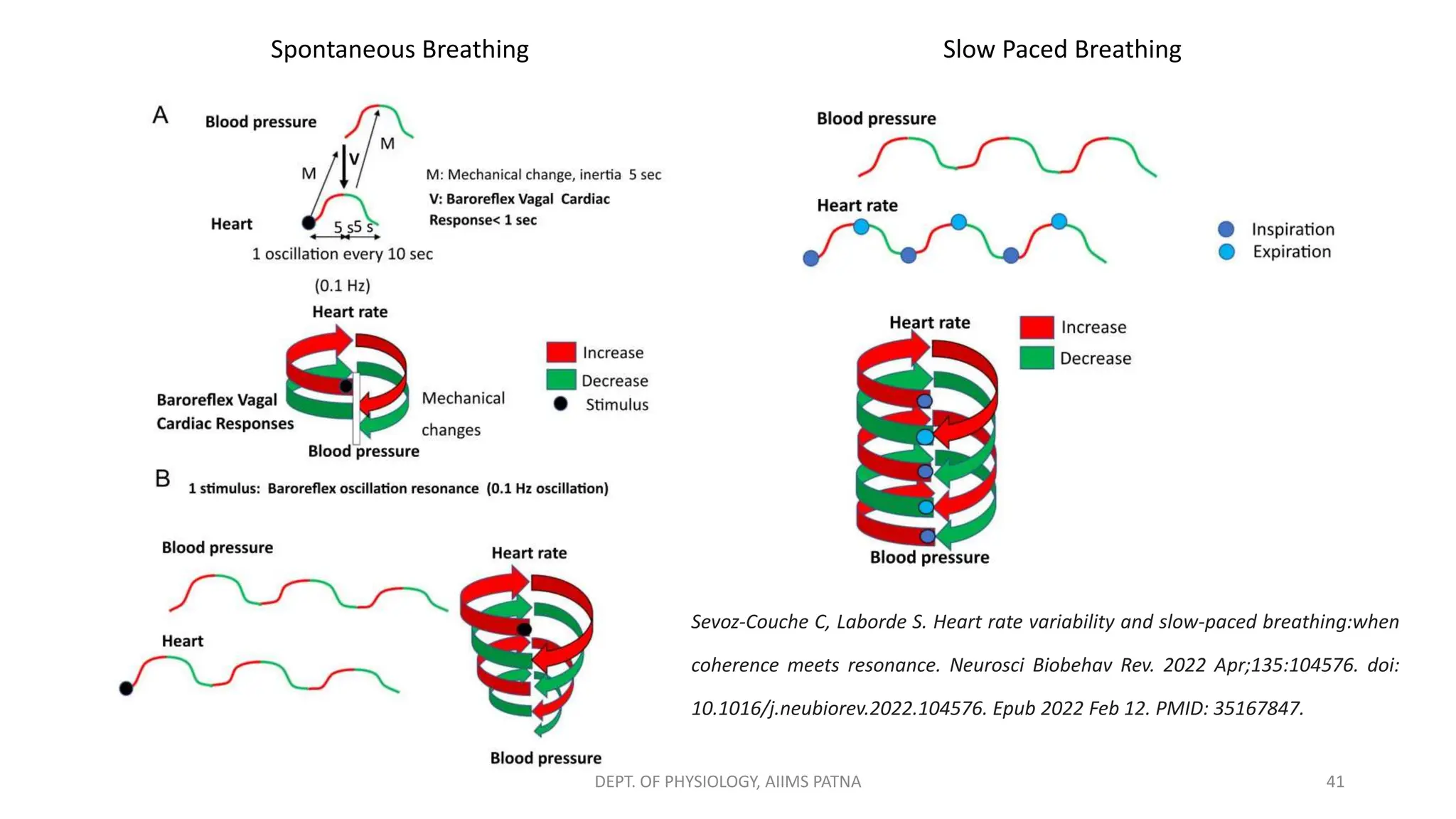 41
DEPT. OF PHYSIOLOGY, AIIMS PATNA
Spontaneous Breathing Slow Paced Breathing
Sevoz-Couche C, Laborde S. Heart rate variability and slow-paced breathing:when
coherence meets resonance. Neurosci Biobehav Rev. 2022 Apr;135:104576. doi:
10.1016/j.neubiorev.2022.104576. Epub 2022 Feb 12. PMID: 35167847.
 