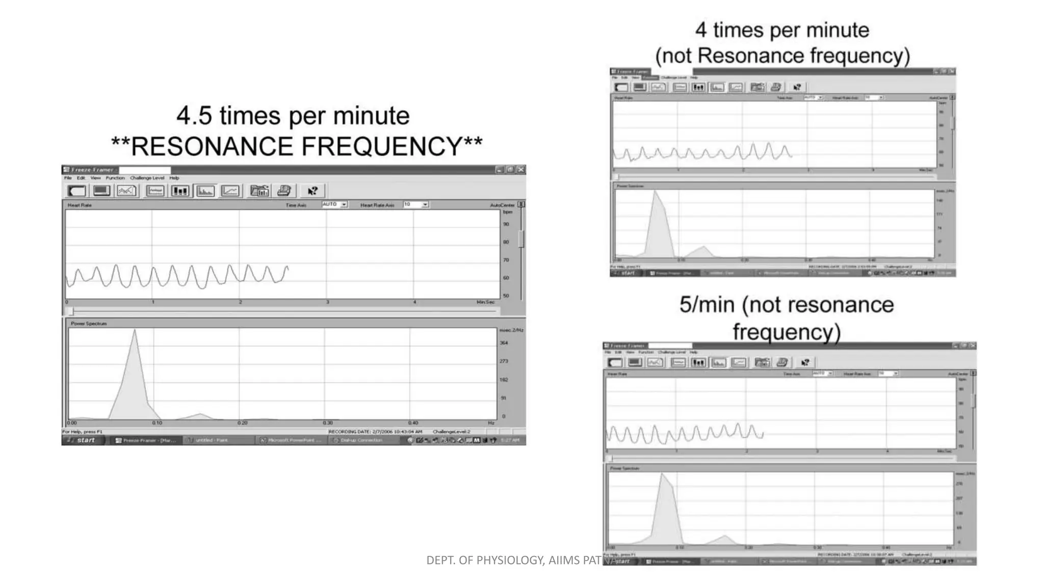 56
DEPT. OF PHYSIOLOGY, AIIMS PATNA
 