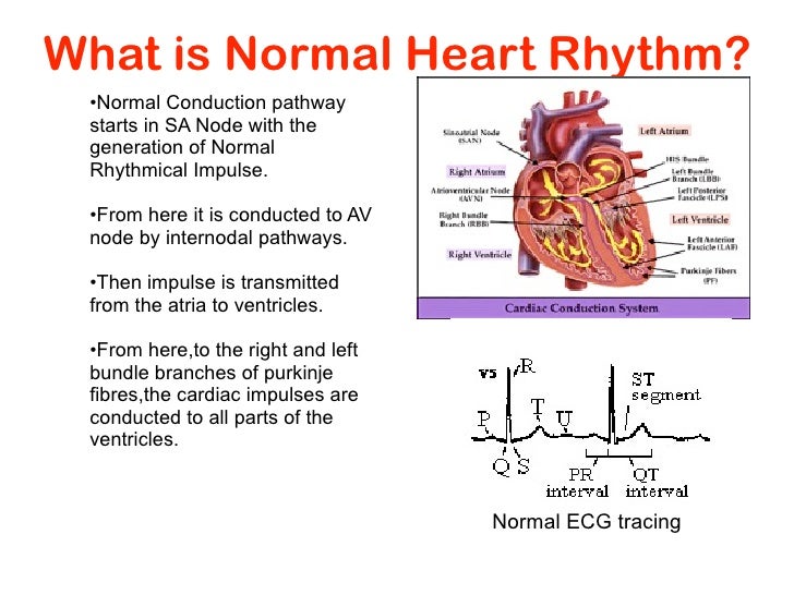 Heart Disease and Heart Rhythm Management