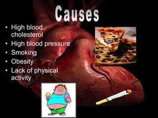 High blood cholesterol High blood pressure Smoking Obesity Lack of physical activity Causes 