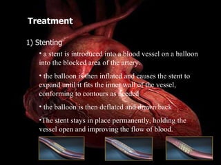 Treatment 1) Stenting a stent is introduced into a blood vessel on a balloon into the blocked area of the artery. the balloon is then inflated and causes the stent to expand until it fits the inner wall of the vessel, conforming to contours as needed the balloon is then deflated and drawn back The stent stays in place permanently, holding the vessel open and improving the flow of blood. 