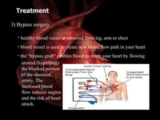 Treatment 3) Bypass surgery healthy blood vessel is removed from leg, arm or chest blood vessel is used to create new blood flow path in your heart the “bypass graft” enables blood to reach your heart by flowing around (bypassing) the blocked portion of the diseased artery. The increased blood flow reduces angina and the risk of heart attack. 