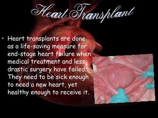 Heart transplants are done as a life-saving measure for end-stage heart failure when medical treatment and less drastic surgery have failed. They need to be sick enough to need a new heart, yet healthy enough to receive it.  Heart Transplant 