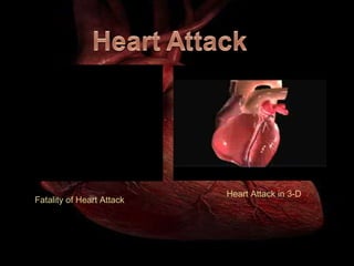 Fatality of Heart Attack Heart Attack in 3-D 