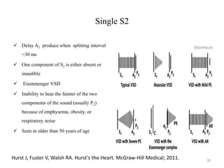 Heart sounds | PPTX