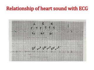 Relationship of heart sound with ECG
 