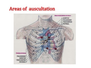 Areas of auscultation
 