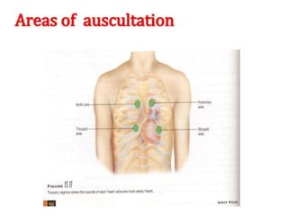 Areas of auscultation
 