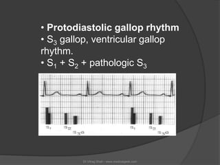 • Protodiastolic gallop rhythm
• S3 gallop, ventricular gallop
rhythm.
• S1 + S2 + pathologic S3




         Dr.Vitrag Sh...