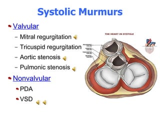 Systolic Murmurs Valvular Mitral regurgitation Tricuspid regurgitation Aortic stenosis  Pulmonic stenosis  Nonvalvular PDA  VSD 