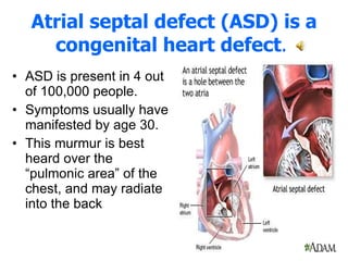 Atrial septal defect (ASD) is a congenital heart defect .   ASD is present in 4 out of 100,000 people.  Symptoms usually have manifested by age 30.  This murmur is best heard over the “pulmonic area” of the chest, and may radiate into the back 