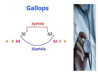 Gallops   systole S1     S2 S4   S3 diastole 