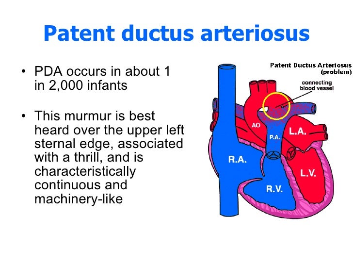 Heart Sounds And Murmurs