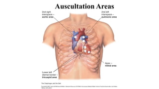 Auscultation Areas
 