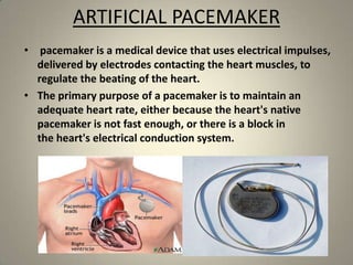 ARTIFICIAL PACEMAKER
• pacemaker is a medical device that uses electrical impulses,
delivered by electrodes contacting the heart muscles, to
regulate the beating of the heart.
• The primary purpose of a pacemaker is to maintain an
adequate heart rate, either because the heart's native
pacemaker is not fast enough, or there is a block in
the heart's electrical conduction system.

 