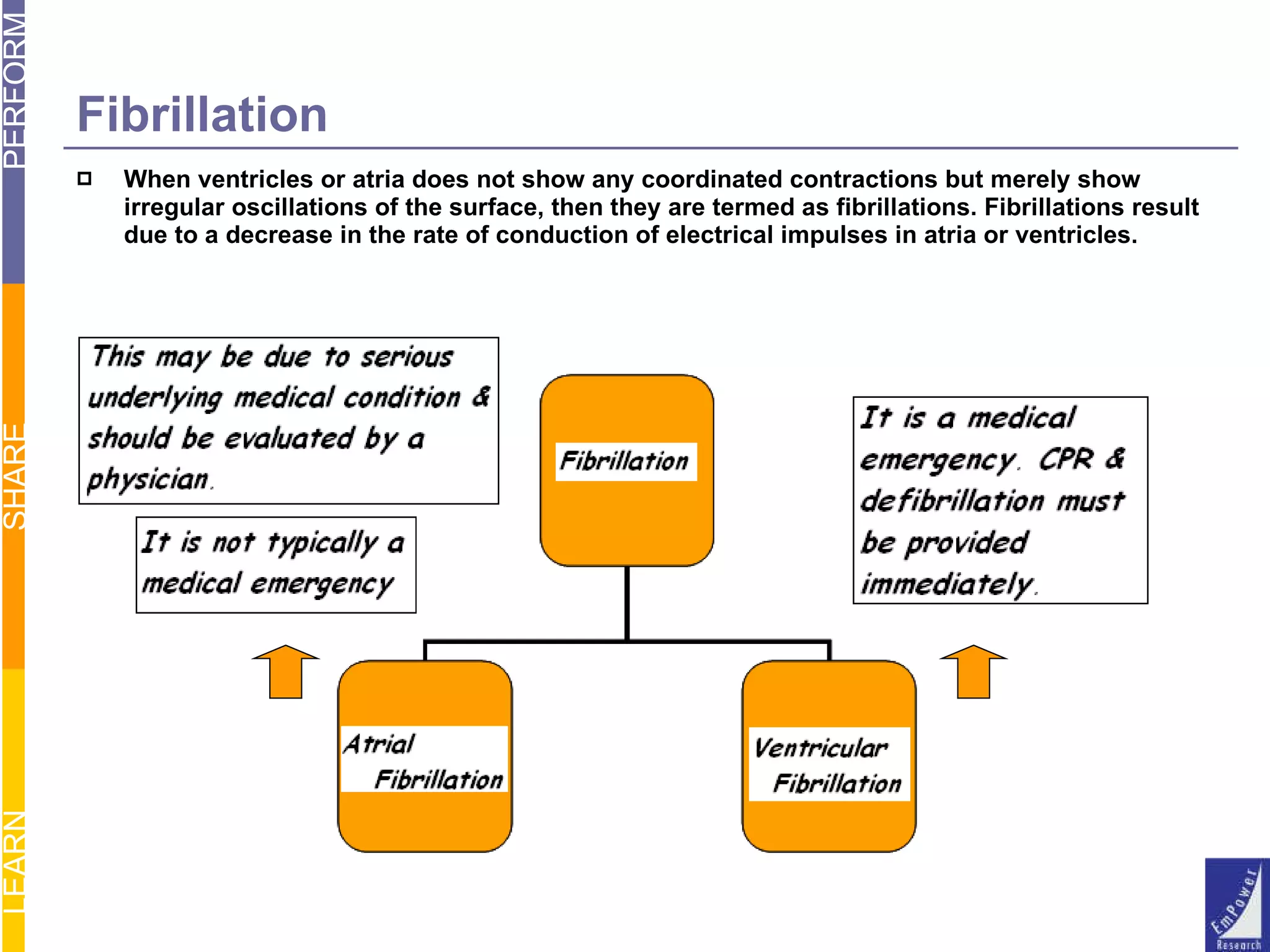 Fibrillation When ventricles or atria does not show any coordinated contractions but merely show irregular oscillations of the surface, then they are termed as fibrillations. Fibrillations result due to a decrease in the rate of conduction of electrical impulses in atria or ventricles. 