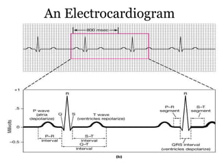 An Electrocardiogram 