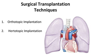 Surgical Transplantation
Techniques
1. Orthotopic Implantation
2. Hertotopic Implantation
 