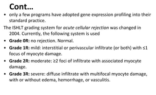 Cont…
• only a few programs have adopted gene expression profiling into their
standard practice.
The ISHLT grading system for acute cellular rejection was changed in
2004. Currently, the following system is used
• Grade 0R: no rejection. Normal.
• Grade 1R: mild: interstitial or perivascular infiltrate (or both) with ≤1
focus of myocyte damage.
• Grade 2R: moderate: ≥2 foci of infiltrate with associated myocyte
damage.
• Grade 3R: severe: diffuse infiltrate with multifocal myocyte damage,
with or without edema, hemorrhage, or vasculitis.
 