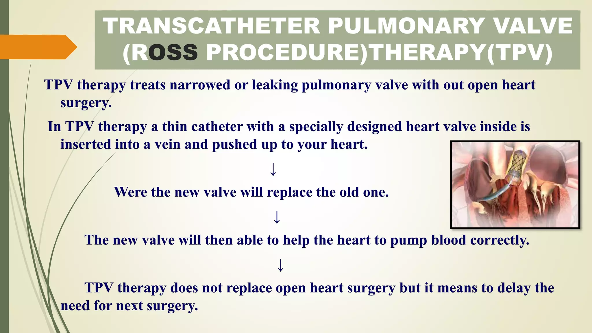 TRANSCATHETER PULMONARY VALVE
(ROSS PROCEDURE)THERAPY(TPV)
TPV therapy treats narrowed or leaking pulmonary valve with out open heart
surgery.
In TPV therapy a thin catheter with a specially designed heart valve inside is
inserted into a vein and pushed up to your heart.
↓
Were the new valve will replace the old one.
↓
The new valve will then able to help the heart to pump blood correctly.
↓
TPV therapy does not replace open heart surgery but it means to delay the
need for next surgery.
 