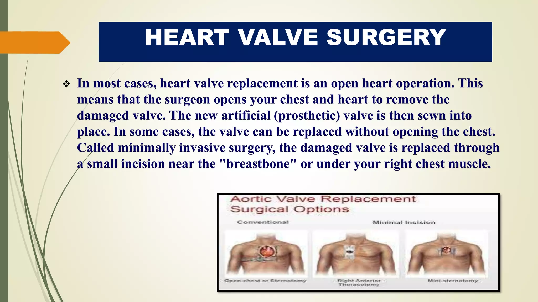 HEART VALVE SURGERY
 In most cases, heart valve replacement is an open heart operation. This
means that the surgeon opens your chest and heart to remove the
damaged valve. The new artificial (prosthetic) valve is then sewn into
place. In some cases, the valve can be replaced without opening the chest.
Called minimally invasive surgery, the damaged valve is replaced through
a small incision near the "breastbone" or under your right chest muscle.
 