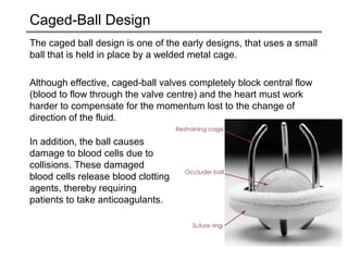 Caged-Ball Design 
The caged ball design is one of the early designs, that uses a small 
ball that is held in place by a welded metal cage. 
Although effective, caged-ball valves completely block central flow 
(blood to flow through the valve centre) and the heart must work 
harder to compensate for the momentum lost to the change of 
direction of the fluid. 
In addition, the ball causes 
damage to blood cells due to 
collisions. These damaged 
blood cells release blood clotting 
agents, thereby requiring 
patients to take anticoagulants. 
 