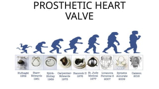 ANATOMY OF HEART VALVES AND PROSTHETIC VALVES pptx