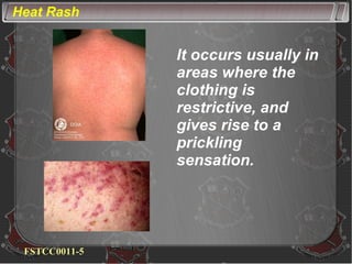 Heated Fan Rash Heat Injury Prevention | PPT