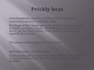 heat 1. heat and related illness ppt.ppt