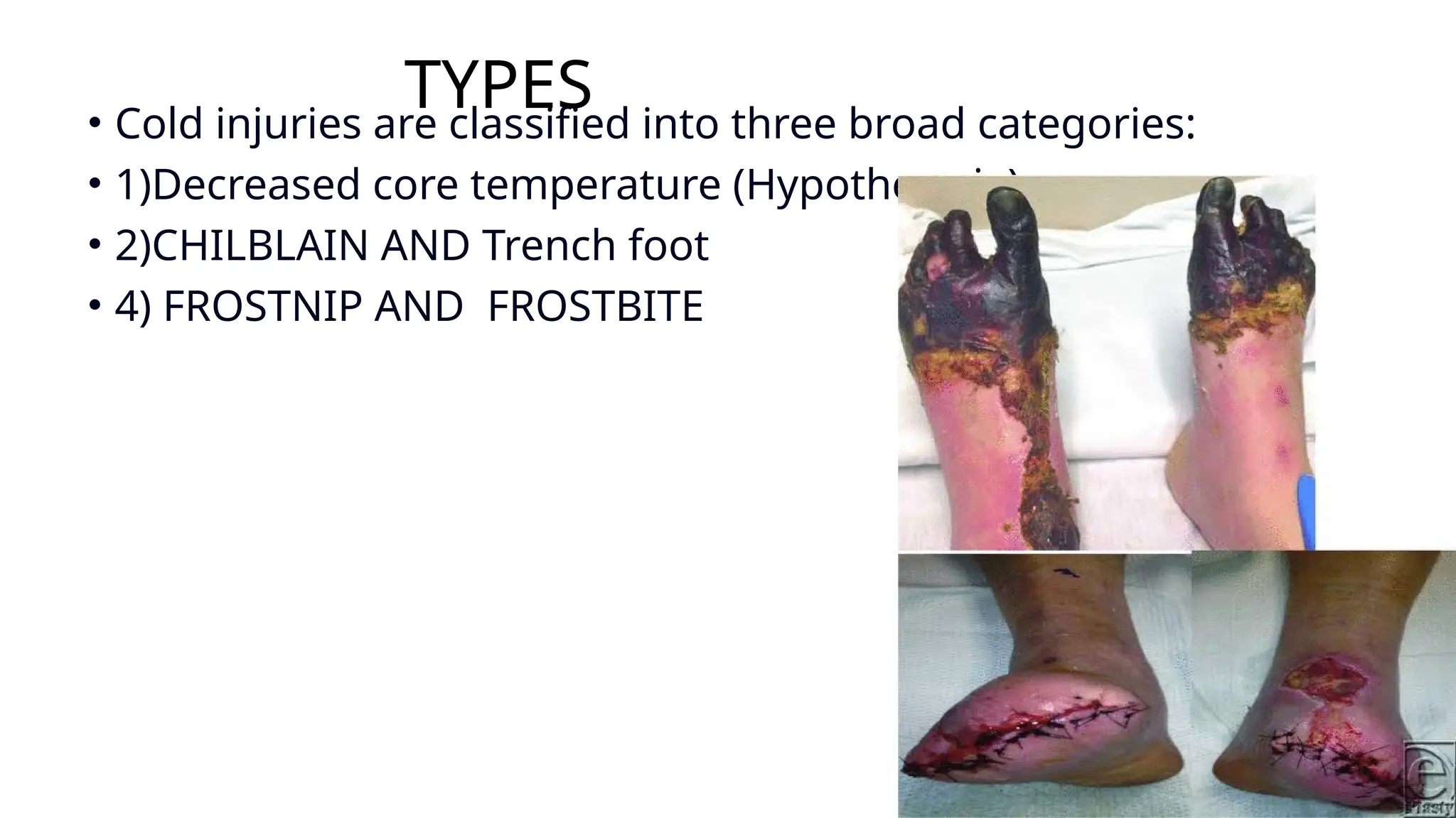 medical ijuries heat and cold injury.pptx