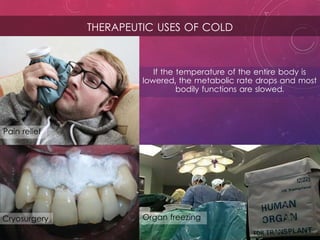 THERAPEUTIC USES OF COLD
Cryosurgery Organ freezing
Pain relief
If the temperature of the entire body is
lowered, the metabolic rate drops and most
bodily functions are slowed.
 