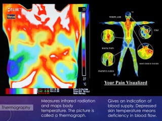 Thermography
Gives an indication of
blood supply. Depressed
skin temperature means
deficiency in blood flow.
Measures infrared radiation
and maps body
temperature. The picture is
called a thermograph.
 