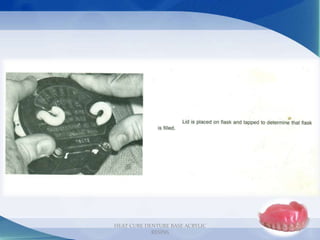 29
HEAT CURE DENTURE BASE ACRYLIC
RESINS
 