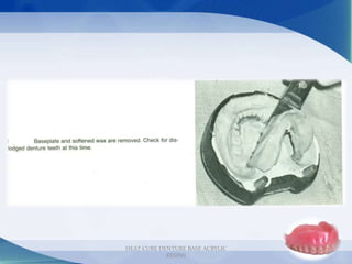 31
HEAT CURE DENTURE BASE ACRYLIC
RESINS
 