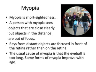 Lens - a transparent body 
behind the iris. The lens 
bends light rays so that they 
form a clear image at the 
back of the eye – on the 
retina. As the lens is elastic, 
it can change shape, getting 
fatter to focus close objects 
and thinner for distant 
objects. 
 