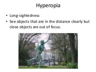 Hyperopia 
• Long-sightedness 
• See objects that are in the distance clearly but 
close objects are out of focus. 
 