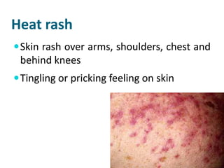 Heat stress | PDF