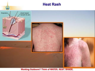 ©2017 Abu Dhabi Company for Onshore Petroleum Operations Ltd. (ADCO). All rights reserved. ADCO Security 4 - Internal Confidential.
 