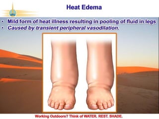 ©2017 Abu Dhabi Company for Onshore Petroleum Operations Ltd. (ADCO). All rights reserved. ADCO Security 4 - Internal Confidential.
 