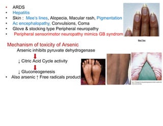 • ARDS
• Hepatitis
• Skin : Mee’s lines, Alopecia, Macular rash, Pigmentation
• Ac encephalopathy, Convulsions, Coma
• Glove & stocking type Peripheral neuropathy
• Peripheral sensorimotor neuropathy mimics GB syndrome
Mechanism of toxicity of Arsenic
Arsenic inhibits pyruvate dehydrogenase
↓ Citric Acid Cycle activity
↓ Gluconeogenesis
• Also arsenic ↑ Free radicals production
 