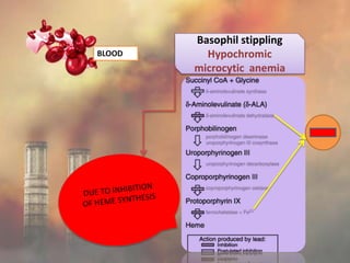 Basophil stippling
Hypochromic
microcytic anemia
BLOOD
 