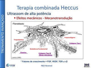 TREINAMENTOAVANÇADO
P&D Ibramed
Terapia combinada Heccus
Ultrassom de alta potência
 Efeitos mecânicos - Mecanotransdução
* Fatores de crescimento = FGF, VEGF, TGF e β
Tropoelastina
Substância fundamental
Tropocolágeno
Elastina Colágeno Tipo III
(fibras reticulares)
Colágeno Tipo I
Fibroblasto
 