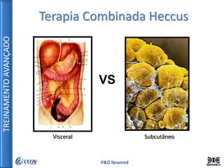 TREINAMENTOAVANÇADO
P&D Ibramed
Terapia Combinada Heccus
Visceral Subcutâneo
VS
 