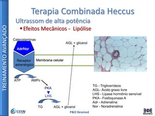 TREINAMENTOAVANÇADO
P&D Ibramed
Terapia Combinada Heccus
Ultrassom de alta potência
Efeitos Mecânicos - Lipólise
Adr/Nor
Receptor
adrenérgico
Membrana celular
ATP AMPc
PKA
LHS
TG AGL + glicerol
Catecolaminas
AGL + glicerol
TG - Triglicerídeos
AGL- Ácido graxo livre
LHS - Lipase hormônio sensível
PKA - Fosfoquinase A
Adr - Adrenalina
Nor - Noradrenalina
 