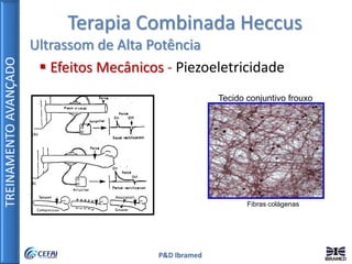 TREINAMENTOAVANÇADO
P&D Ibramed
Terapia Combinada Heccus
Ultrassom de Alta Potência
 Efeitos Mecânicos - Piezoeletricidade
Fibras colágenas
Tecido conjuntivo frouxo
 