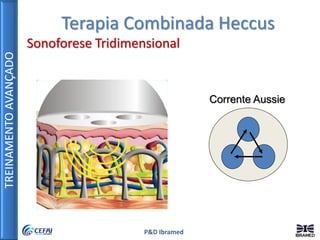 TREINAMENTOAVANÇADO
P&D Ibramed
Terapia Combinada Heccus
Sonoforese Tridimensional
Corrente Aussie
 
