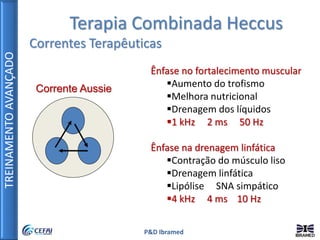 TREINAMENTOAVANÇADO
P&D Ibramed
Terapia Combinada Heccus
Correntes Terapêuticas
Corrente Aussie
Ênfase no fortalecimento muscular
Aumento do trofismo
Melhora nutricional
Drenagem dos líquidos
1 kHz 2 ms 50 Hz
Ênfase na drenagem linfática
Contração do músculo liso
Drenagem linfática
Lipólise SNA simpático
4 kHz 4 ms 10 Hz
 