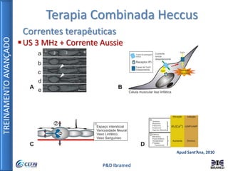TREINAMENTOAVANÇADO
P&D Ibramed
Apud Sant’Ana, 2010
Terapia Combinada Heccus
Correntes terapêuticas
US 3 MHz + Corrente Aussie
 