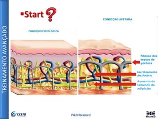 TREINAMENTOAVANÇADO
P&D Ibramed
Start
 